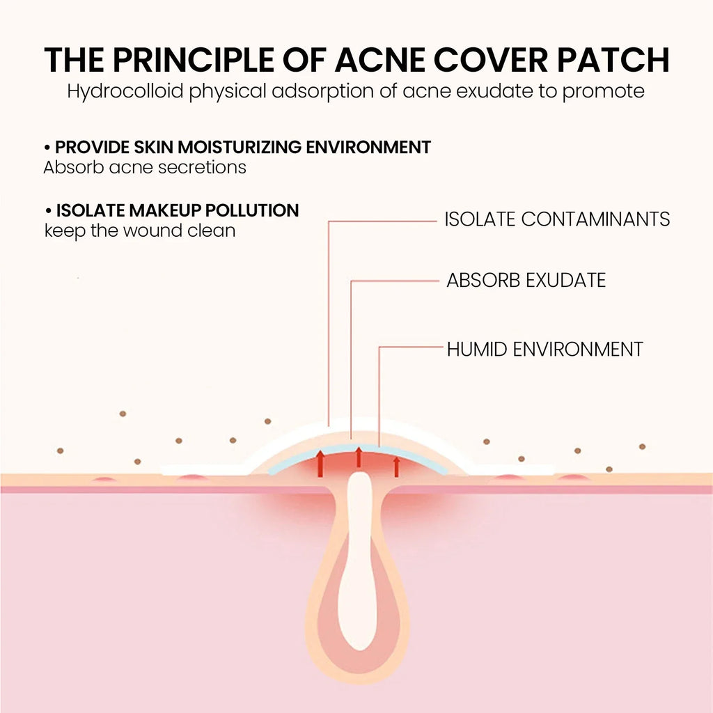 Pimple Patches,Pimple Patches For Face, Hydrocolloid Acne Patches, Cute Star Sti-Shop